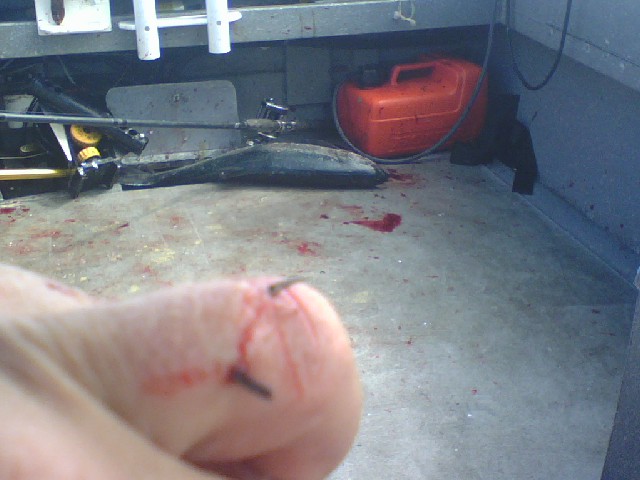 Sept_2010_Westport_hooked_finger.jpg